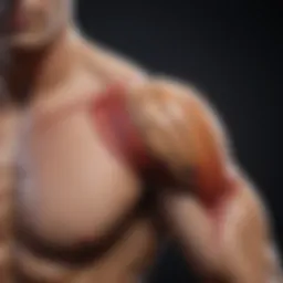 Illustration of shoulder anatomy highlighting dislocation